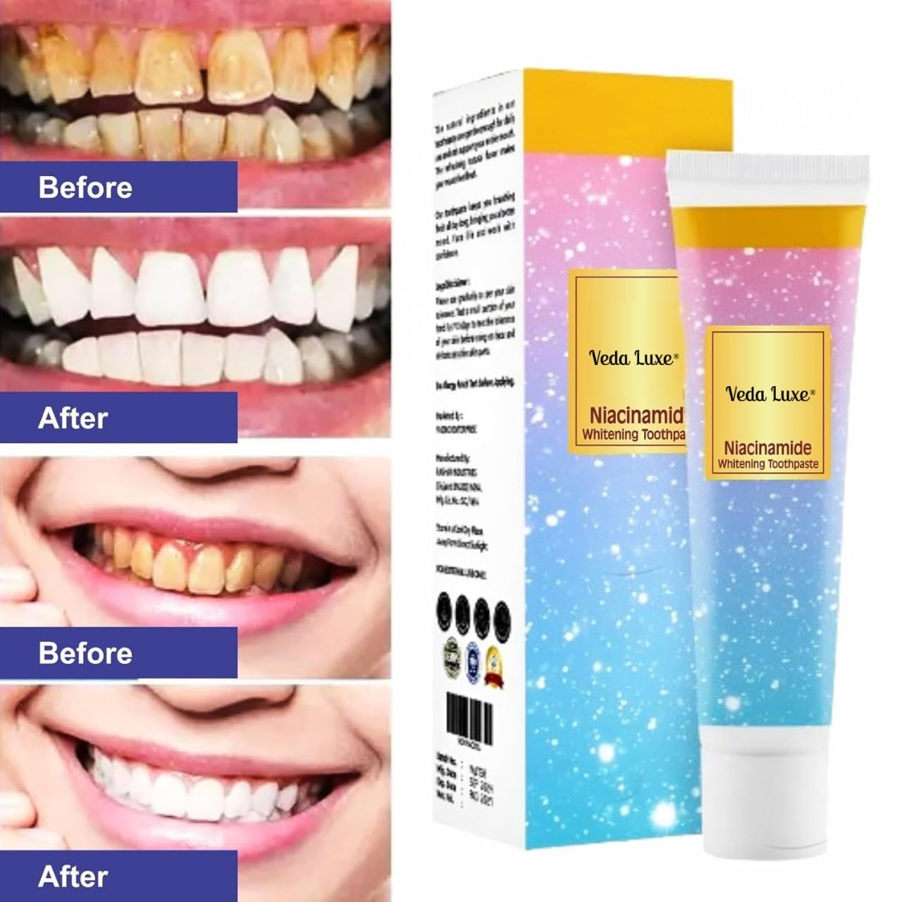 Niacinamide Whitening Toothpaste (PACK OF 2)