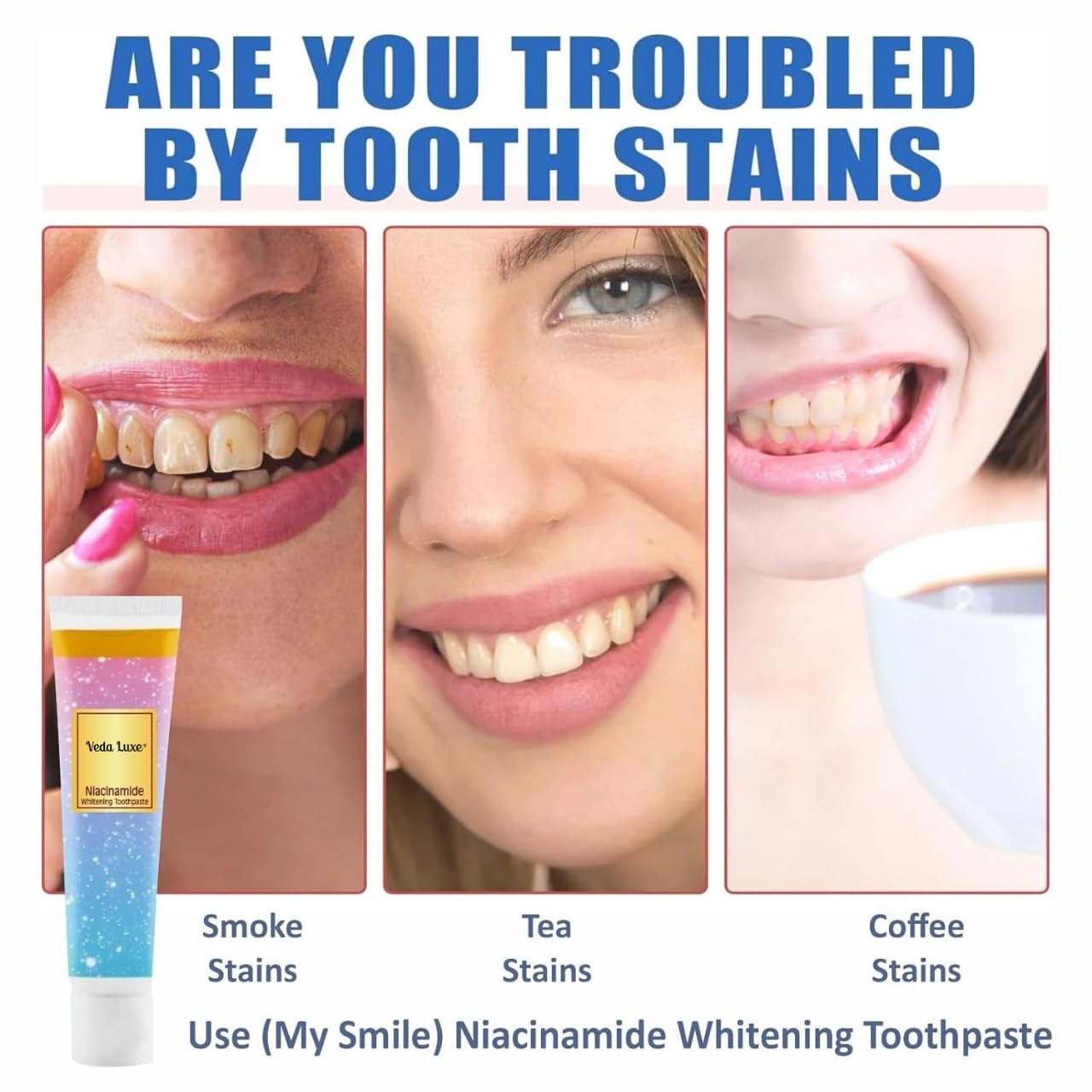 Niacinamide Whitening Toothpaste (PACK OF 2)